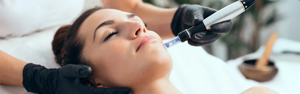 Microneedling