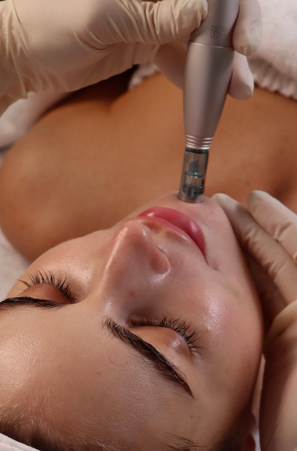 Microneedling Aqua stem cell