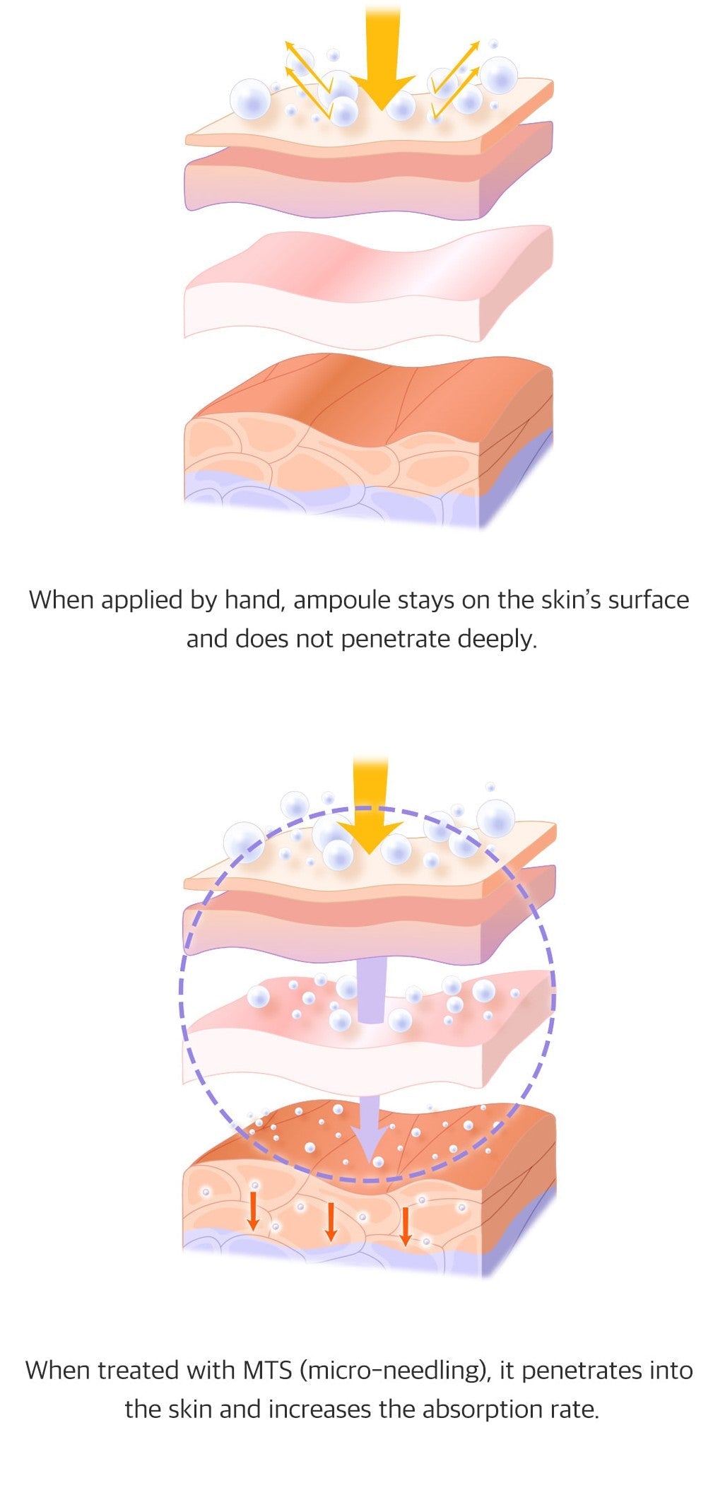 Microneedling Hautelastizität mit  Idebenone- Früchte extrakt