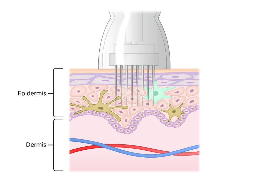 Microneedling Skin Booster -Citron+Calendula